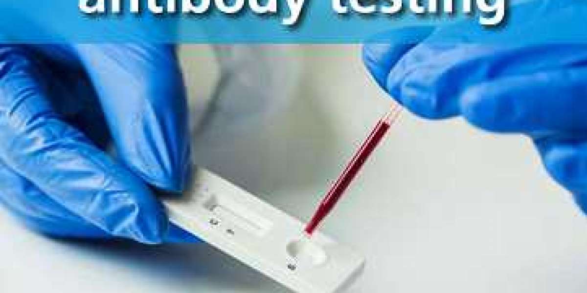 North Hills Covid 19 Antibody Test