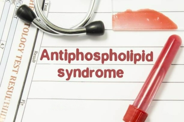 Antiphospholipid Syndrome: What You Need to Know | by Haem Cares | Feb, 2023 | Medium