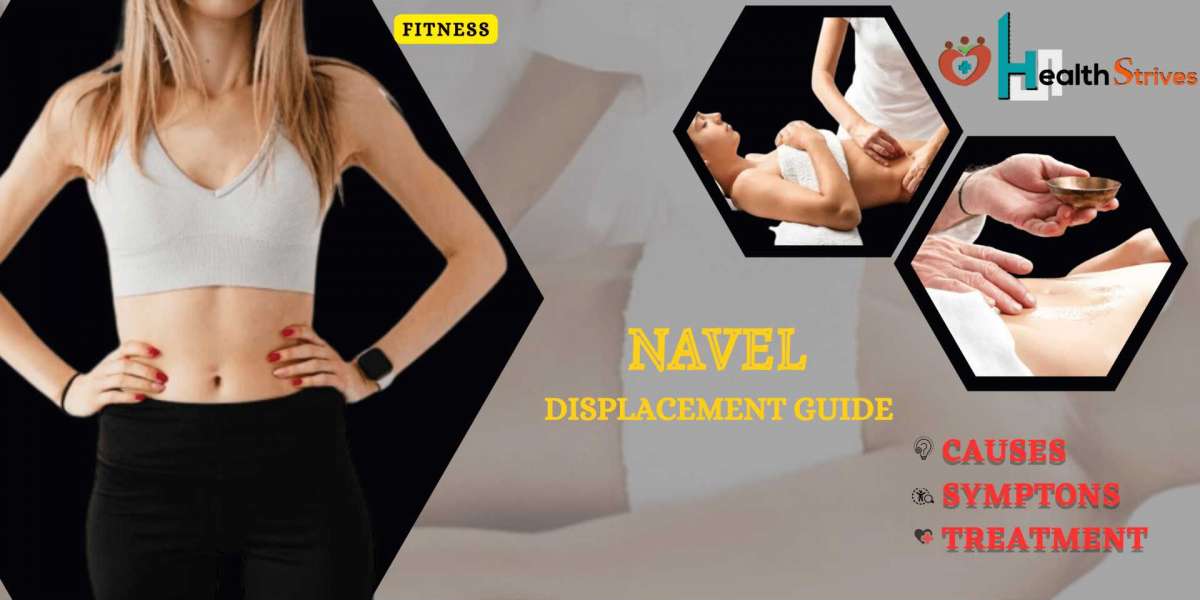 How Much Do You Know about Navel Displacement?