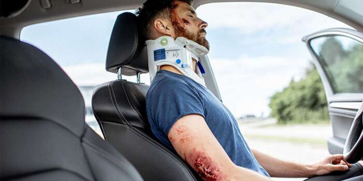 The Role of Personal Injury Attorneys in Los Angeles Accident Cases: By Uber Lawyer Injury and Accident Attorneys