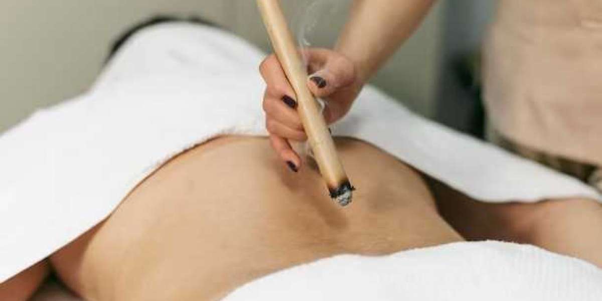 Navigating Wellness: Decoding Acupuncture's Influence on Weight Reduction