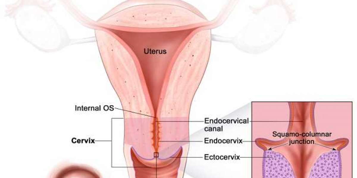 How can one cure herself of cervical cancer?