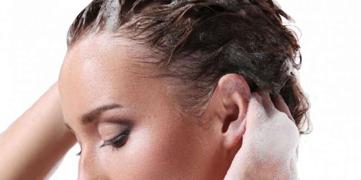 Dandruff Be Gone: Unveiling the Ultimate Solutions with the Best Shampoo for Dandruff