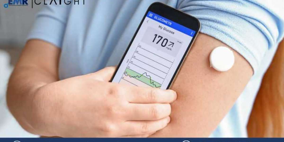 North America Continuous Glucose Monitoring Market Size, Share, Industry Trends, Analysis Growth & Report | 2032