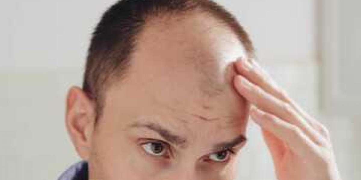 زراعة الشعر في دبي: تفاصيل التكاليف والعوامل