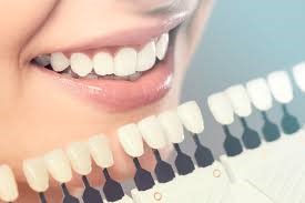 The Importance of Cosmetic Dentistry in Modern Oral Health