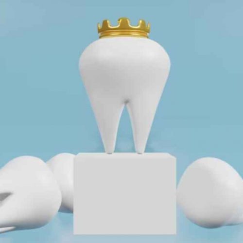 Dental Crowns in Ajman: Affordable Dental Crown Ajman