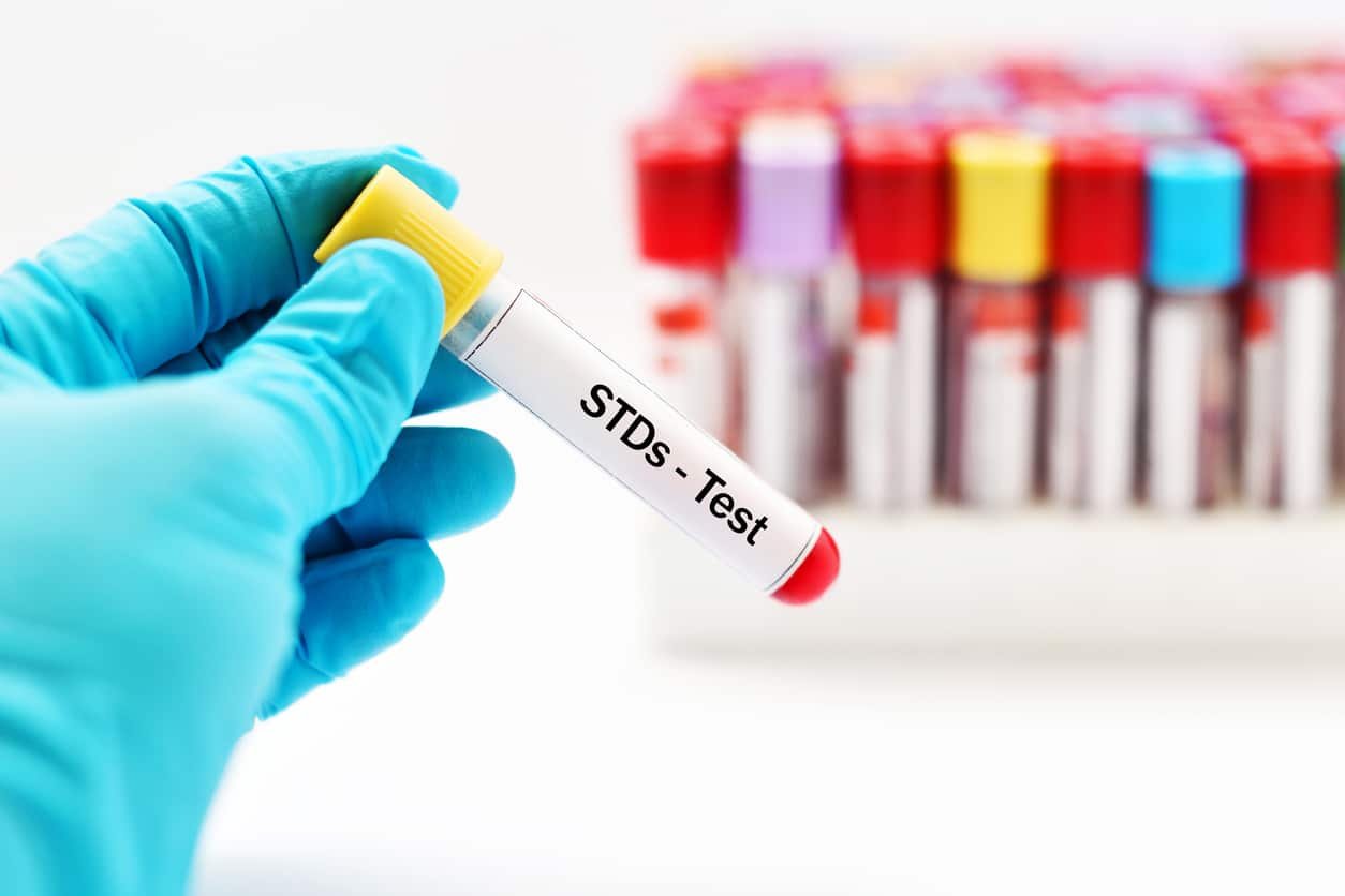 STD Testing Dubai At home 24/7 service.Get tested & Be worry free