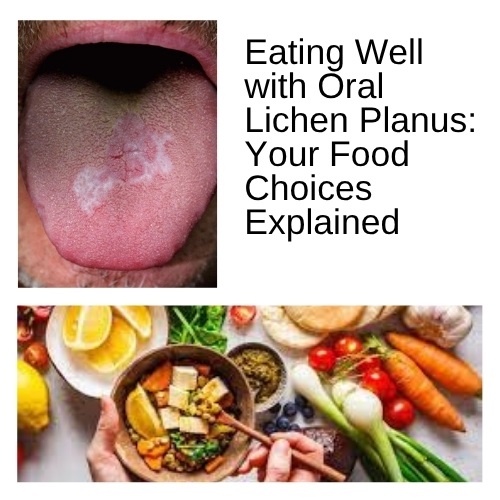 Eating Well with Oral Lichen Planus: Your Food Choices Explained - Natural Herbs Clinic Blog