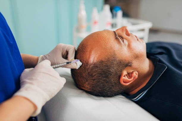How To Boost Hair Growth Naturally With Clinical Support | Hair Regrowth In Kolkata