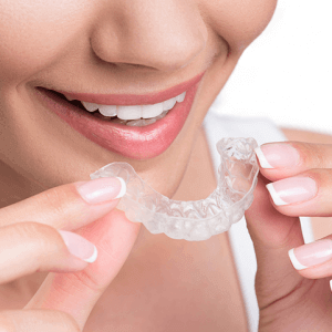 Top Features of Professional Mouth Guards for High-Impact Sports - Software Support Member Article By Best Dental Clinic Preston Smiles Dental Clinic