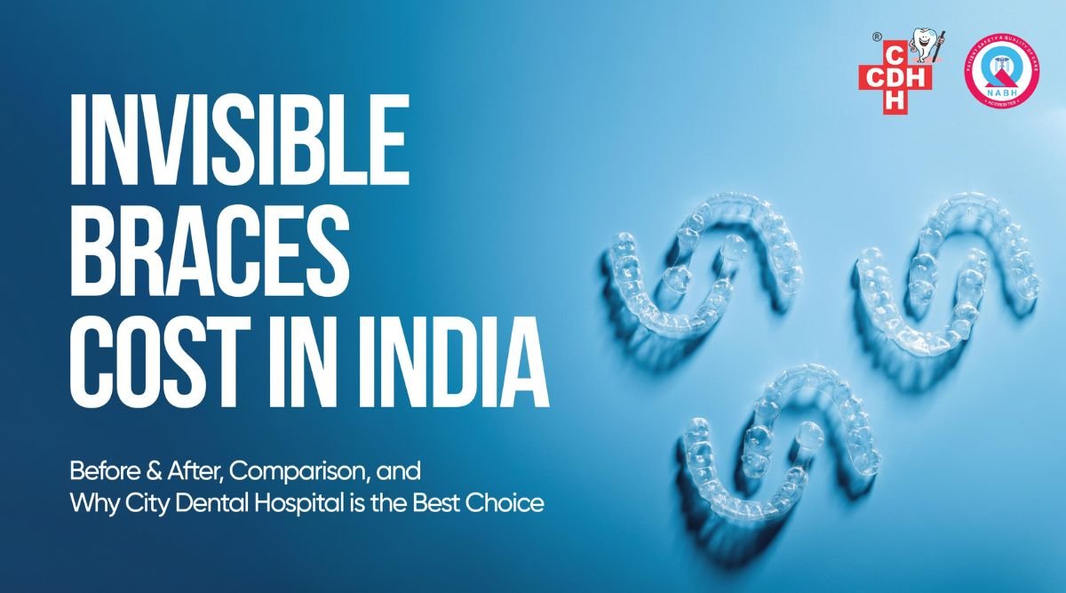Invisible Braces Cost in India – Complete Guide | CDH