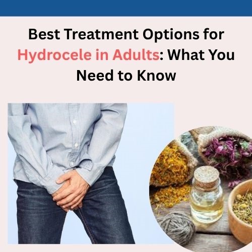 Best Treatment Options for Hydrocele in Adults: What You Need to Know - Natural Health News