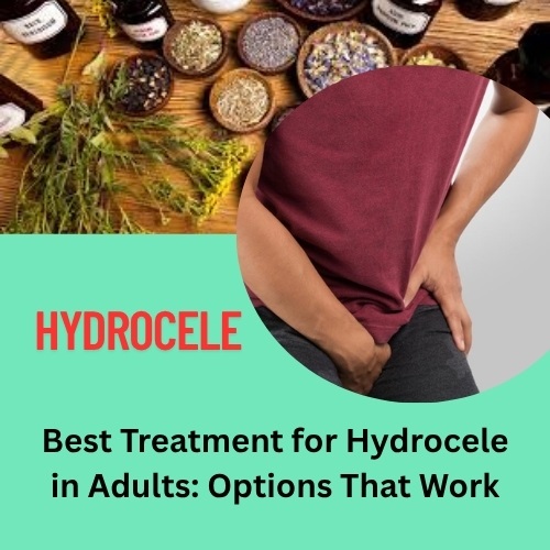 Best Treatment for Hydrocele in Adults: Options That Work - Herbs Solutions By Nature Blog