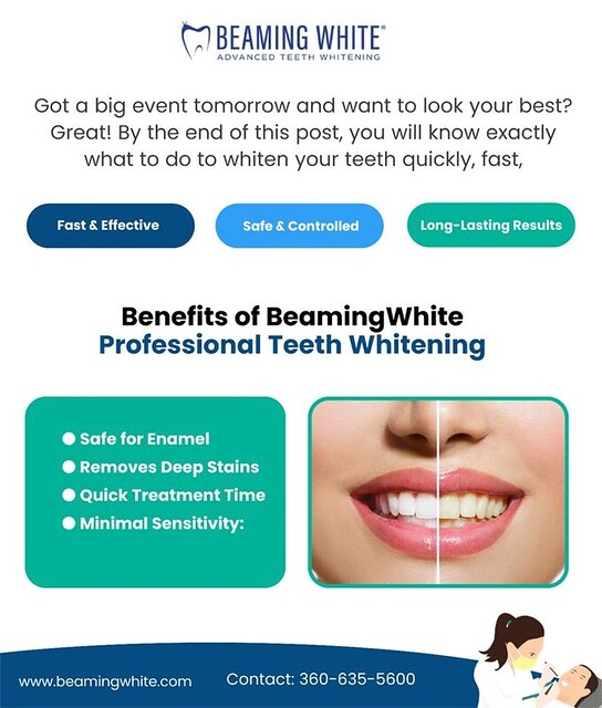 Benefits of BeamingWhite Professional Teeth Whitening | Flickr