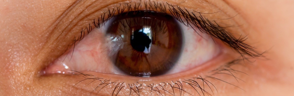 Houston Lasik and Eye Cover Image