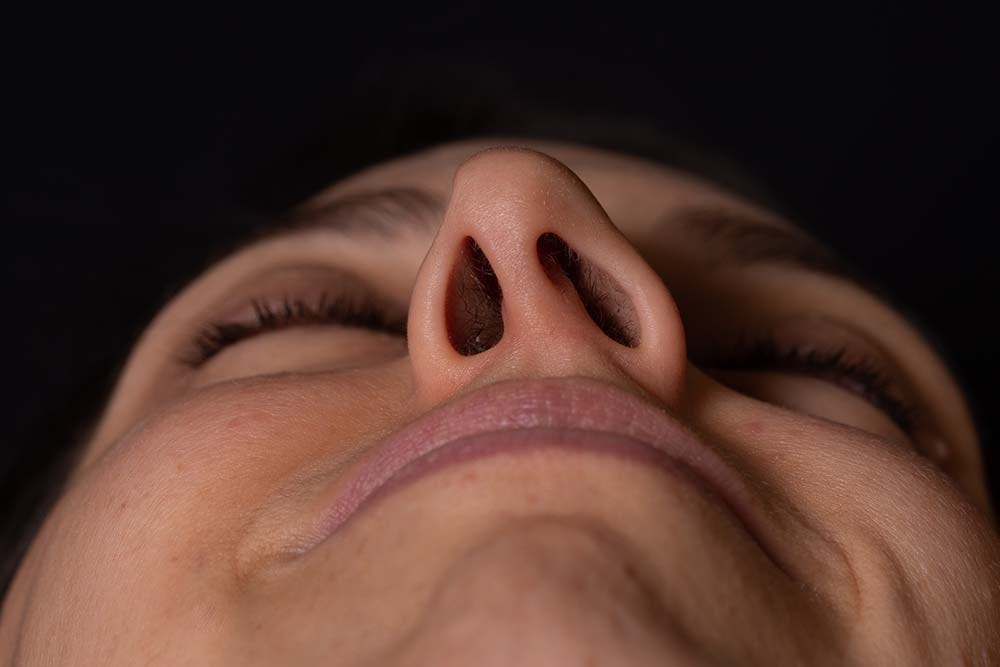 Can Rhinoplasty Help Sinus Problems? | by drrajatgupta | Jul, 2025 | Medium