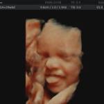 Ultrasound scan Profile Picture