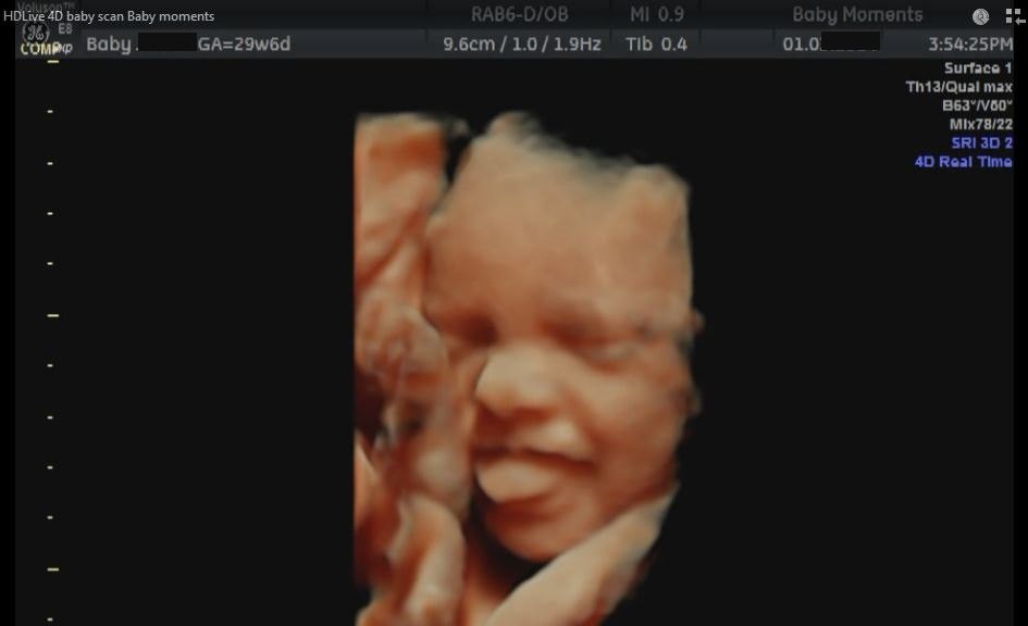 Ultrasound scan Profile Picture
