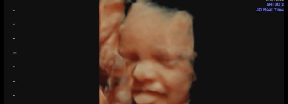 Ultrasound scan Cover Image