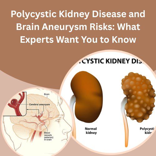 Polycystic Kidney Disease and Brain Aneurysm Risks: What Experts Want You to Know - Herbal Care Products - Blog